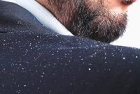 علت «شوره سر» و راه درمان آن چیست؟